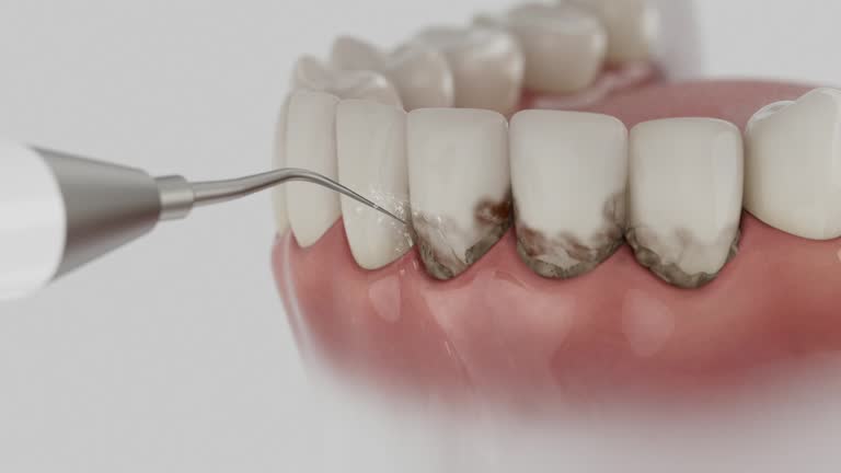 Reliable Dental Implants contractor in Rayne, LA by Smile Center Dentistry